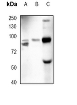 PI3K p85 beta Rabbit Monoclonal Antibody