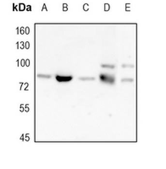 ABCD1 Rabbit Monoclonal Antibody