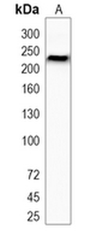 VEGFR2 Rabbit Monoclonal Antibody