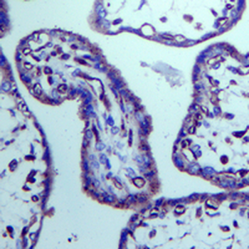 VEGFR2 Rabbit Monoclonal Antibody