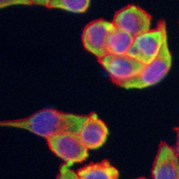 VEGFR2 Rabbit Monoclonal Antibody