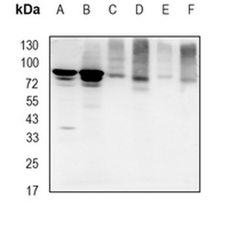 FOXO1 Rabbit Monoclonal Antibody