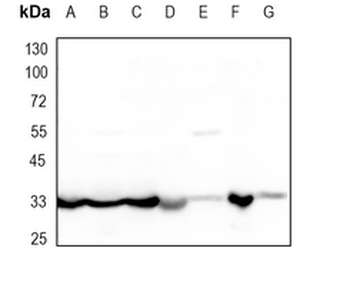 Osteopontin Rabbit Monoclonal Antibody