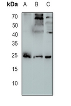RAB11A Rabbit Monoclonal Antibody