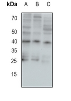 IRP Rabbit Monoclonal Antibody