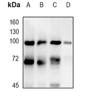 Nibrin Rabbit Monoclonal Antibody