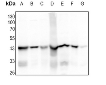ACADM Rabbit Monoclonal Antibody