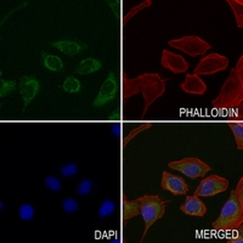 ACADM Rabbit Monoclonal Antibody
