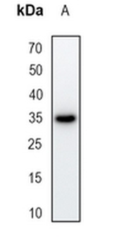 Nmi Rabbit Monoclonal Antibody