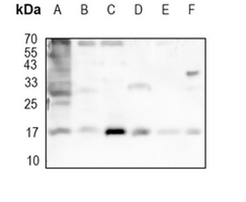 SUMO1 Rabbit Monoclonal Antibody