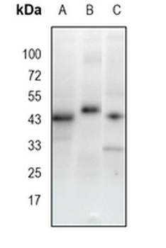 PAX2 Rabbit Monoclonal Antibody