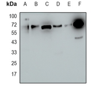 cIAP2 Rabbit Monoclonal Antibody