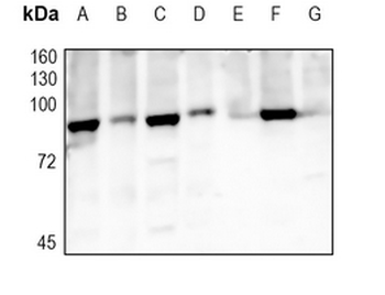 TBK1 Rabbit Monoclonal Antibody