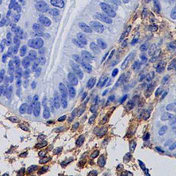 PDGFR beta Rabbit Monoclonal Antibody