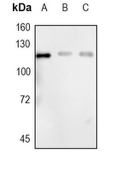 PMS2 Rabbit Monoclonal Antibody