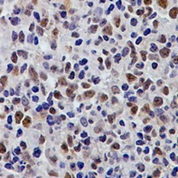 PMS2 Rabbit Monoclonal Antibody