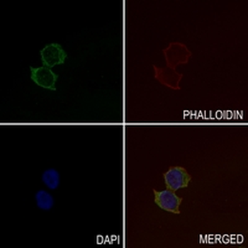 CD282 Rabbit Monoclonal Antibody