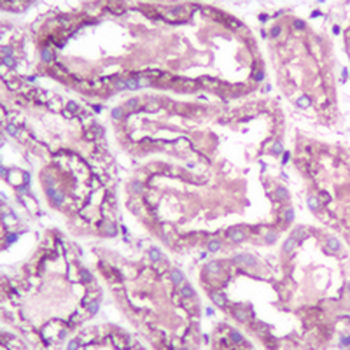 VEGFA Rabbit Monoclonal Antibody