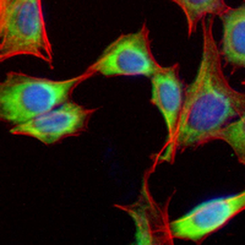 VEGFA Rabbit Monoclonal Antibody