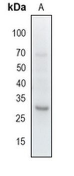 PNMTase Rabbit Monoclonal Antibody