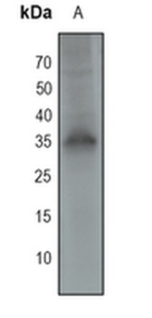 RAD51A Rabbit Monoclonal Antibody