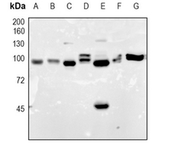 Aconitase 1 Rabbit Monoclonal Antibody