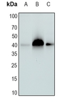 SETD7 Rabbit Monoclonal Antibody