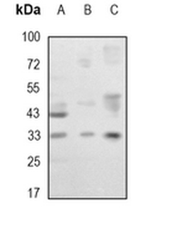 C/EBP beta Rabbit Monoclonal Antibody