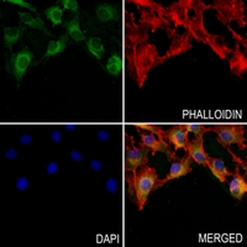 CD325 Rabbit Monoclonal Antibody