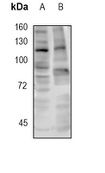 RNF20 Rabbit Monoclonal Antibody
