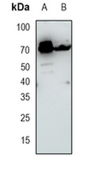 KIFC1 Rabbit Monoclonal Antibody