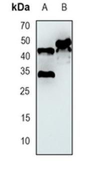 GSK3 beta Rabbit Monoclonal Antibody