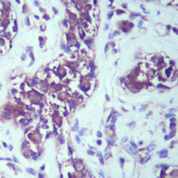 GSK3 beta Rabbit Monoclonal Antibody