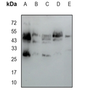 NGRH2 Rabbit Monoclonal Antibody