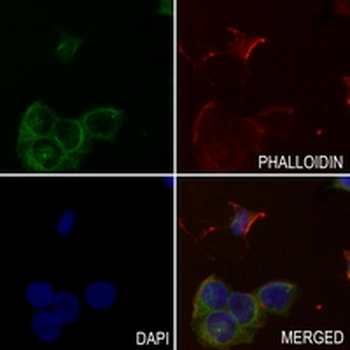 NGRH2 Rabbit Monoclonal Antibody