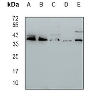 MRPS31 Rabbit Monoclonal Antibody