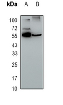 PNKP Rabbit Monoclonal Antibody