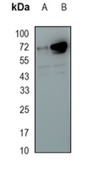 SSTR3 Rabbit Monoclonal Antibody