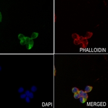 CTPS Rabbit Monoclonal Antibody