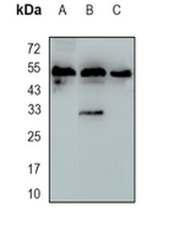 MPP1 Rabbit Monoclonal Antibody