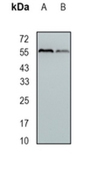 ALDH7A1 Rabbit Monoclonal Antibody
