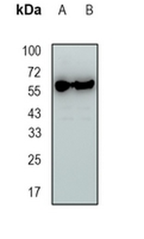 EYA2 Rabbit Monoclonal Antibody
