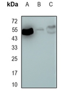 MEF2A Rabbit Monoclonal Antibody