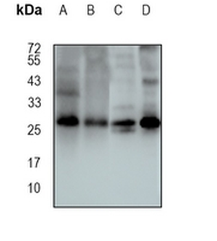 SNAP29 Rabbit Monoclonal Antibody