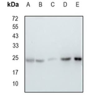 RPL13 Rabbit Monoclonal Antibody