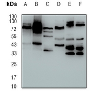 CLPTM1 Rabbit Monoclonal Antibody