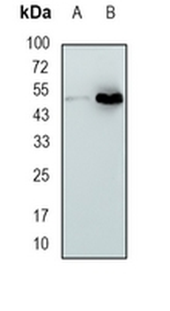 CAP1 Rabbit Monoclonal Antibody