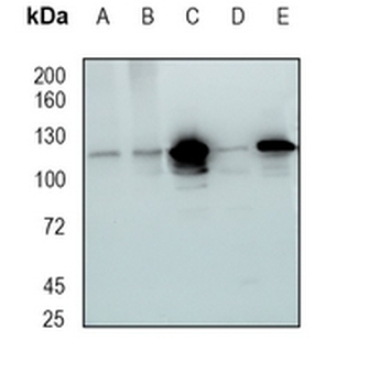 RASA1 Rabbit Monoclonal Antibody