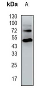 HGD Rabbit Monoclonal Antibody