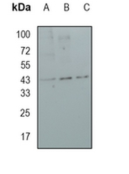 MVD Rabbit Monoclonal Antibody